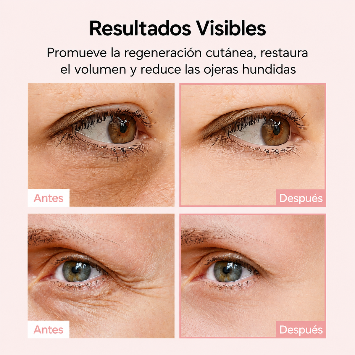 LumiLift™ Balsamo Multiusos